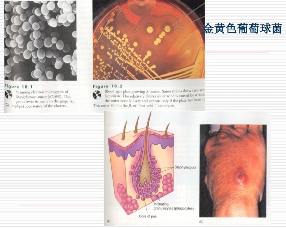 微生物课件－细菌(1-3)_第5页