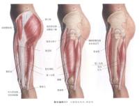 大腿部有肌肉 侧面观－人体解剖图