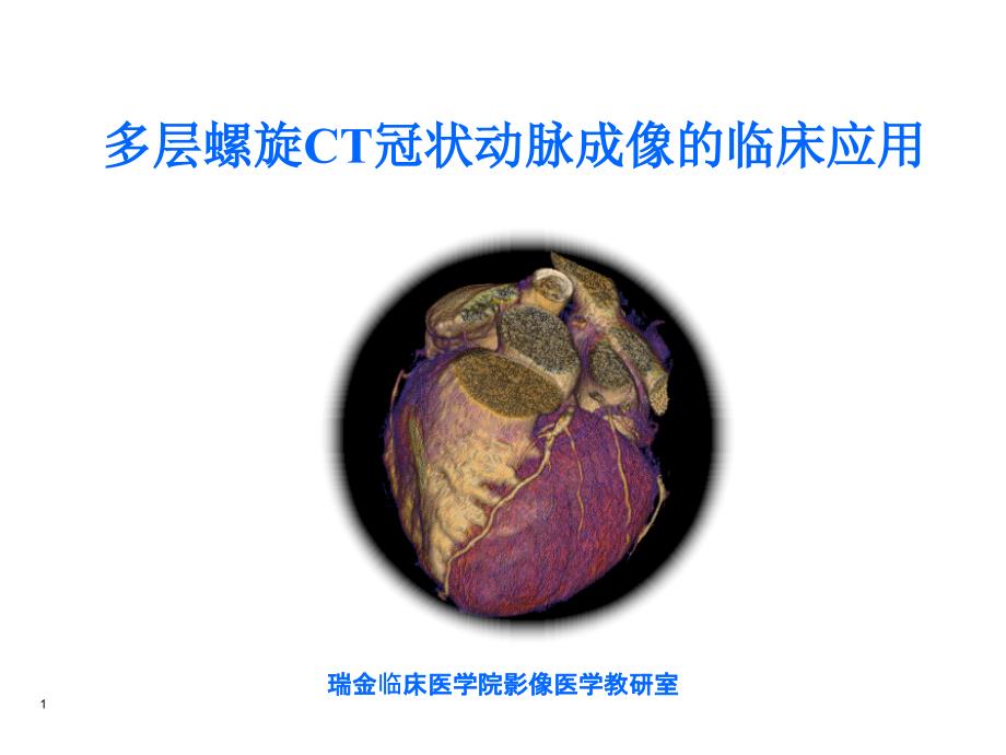 多层CT冠脉成像－医学影像学（上海交通大学医学院）_第1页