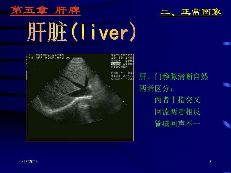 肝脏超声学－医学影像学（上海交通大学医学院）_第5页