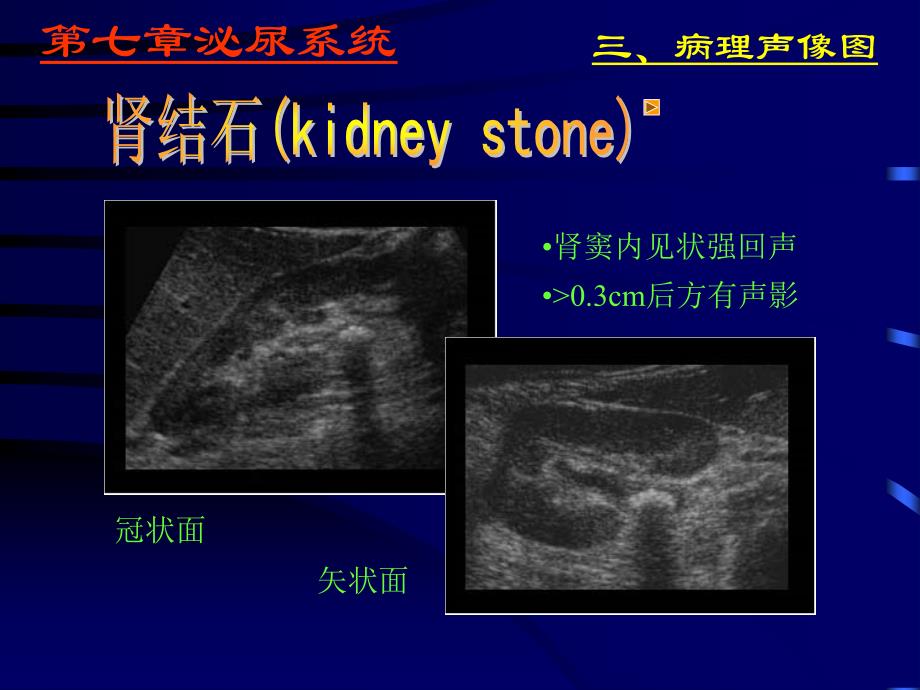 泌尿系统超声学－医学影像学（上海交通大学医学院）_第4页