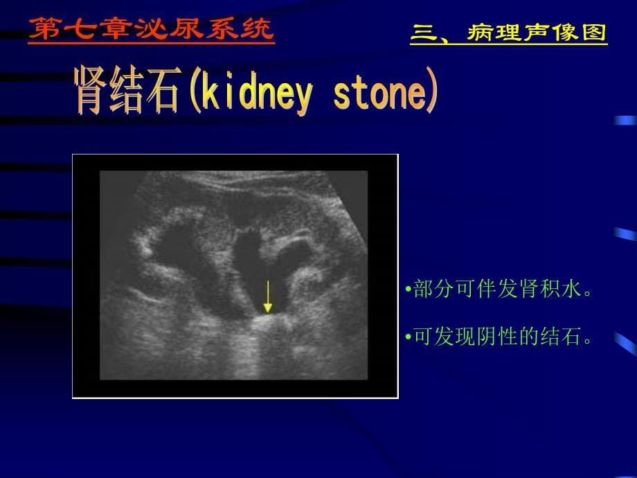 泌尿系统超声学－医学影像学（上海交通大学医学院）_第5页