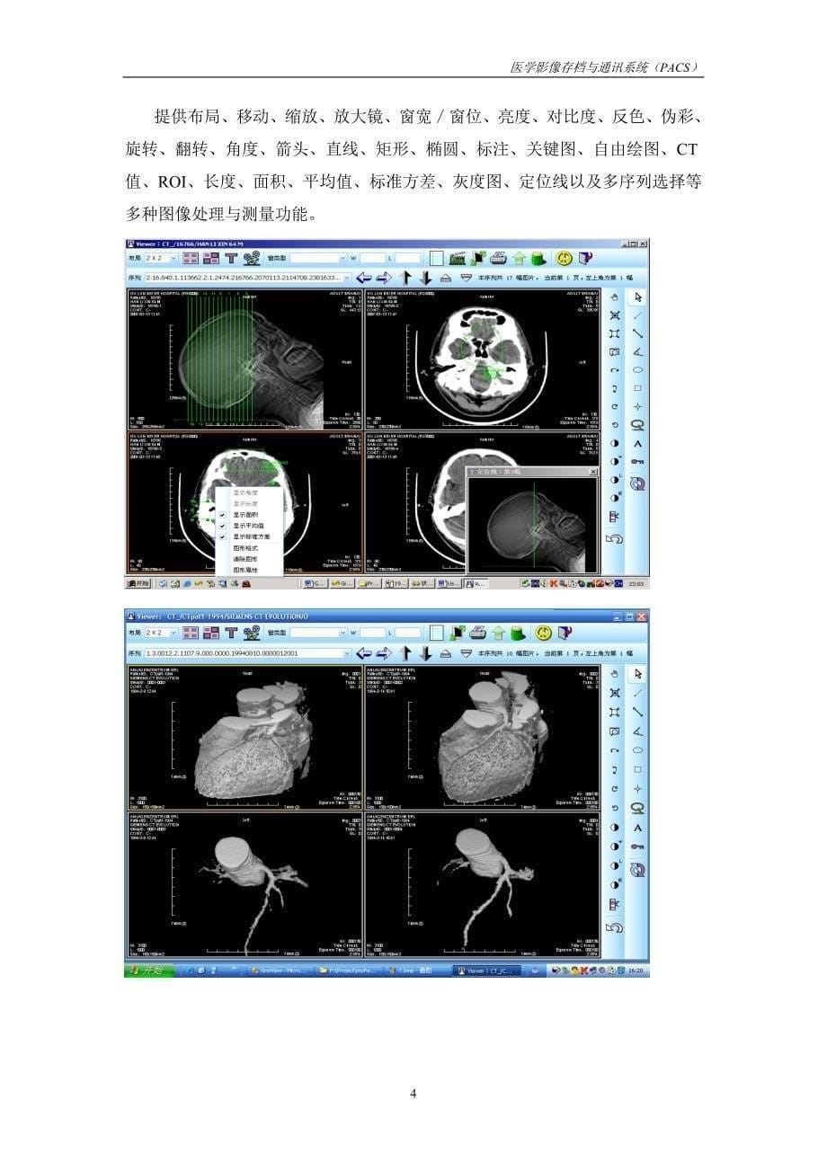 医学影像存档与通讯系统（PACS）产品简介_第5页