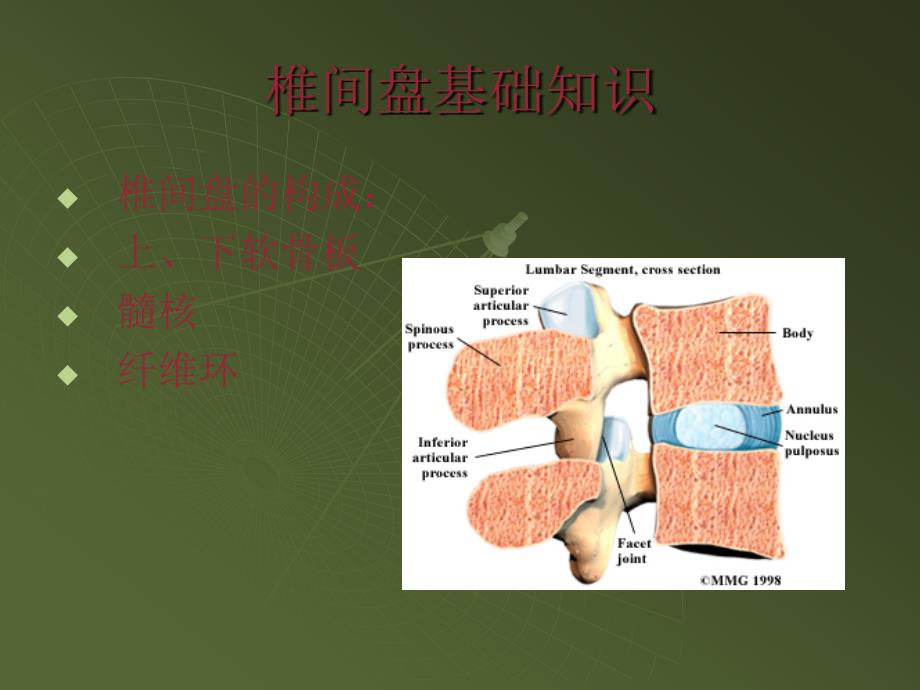 腰椎间盘突出症简易读片_第2页