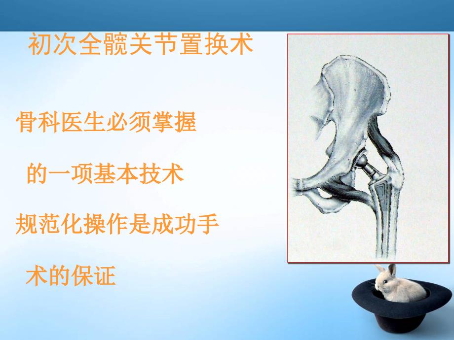 全髋关节置换手术技巧_第2页