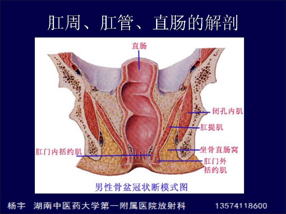 肛周脓肿的MR表现和检查技术_第4页