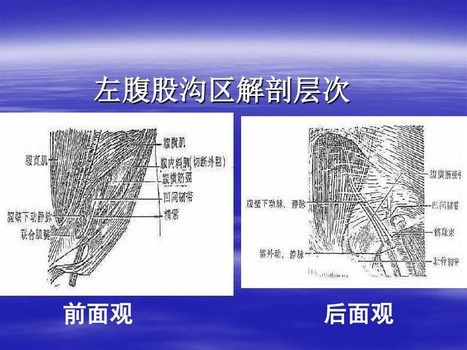 第二节 腹股沟疝92_第5页