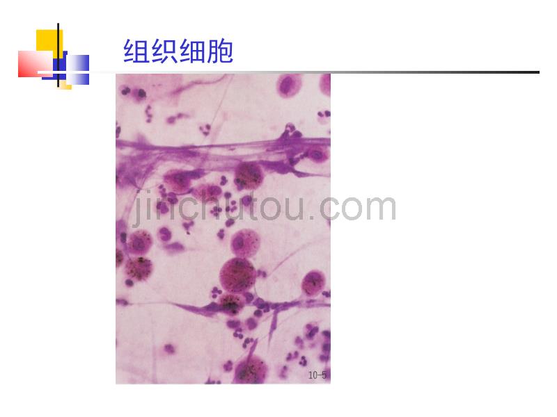 浆膜腔积液脱落细胞学3.ppt_第2页