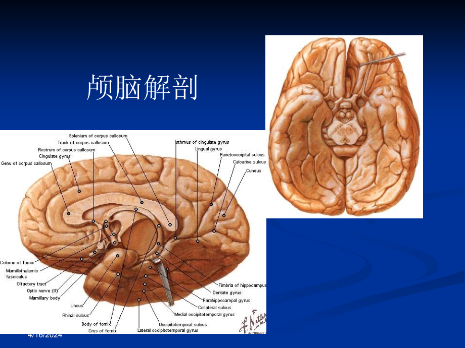 颅脑解剖与常见疾病的CT&MRI表现 PPT课件_第4页