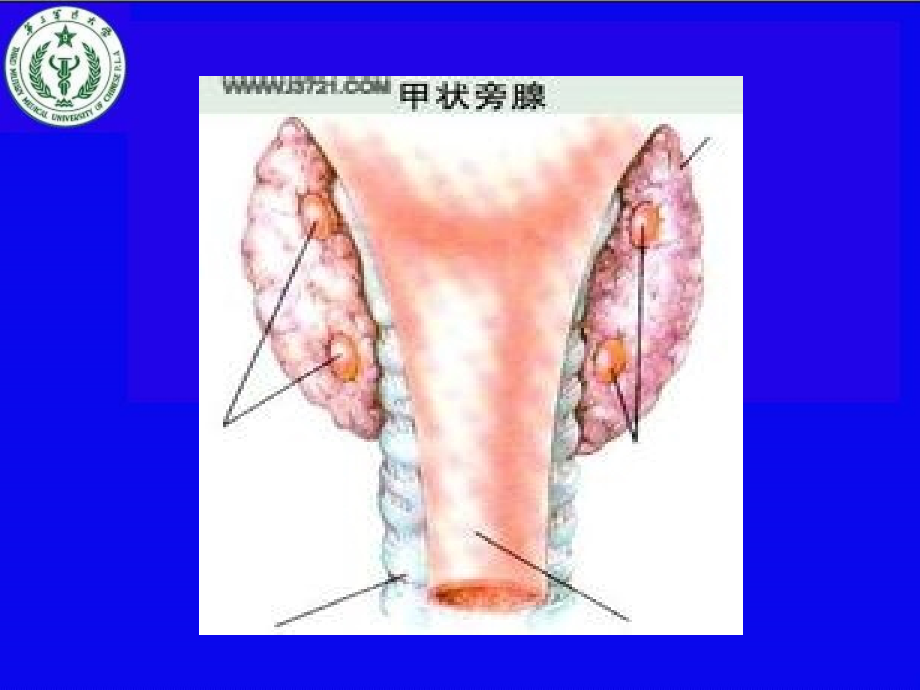 甲旁减与低钙血症幻灯片_第2页