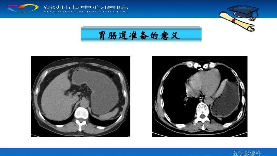 腹部CT检查的胃肠道准备_第5页