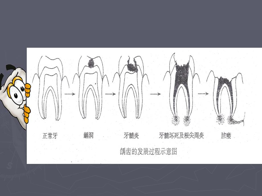 口腔科病人的护理_第4页