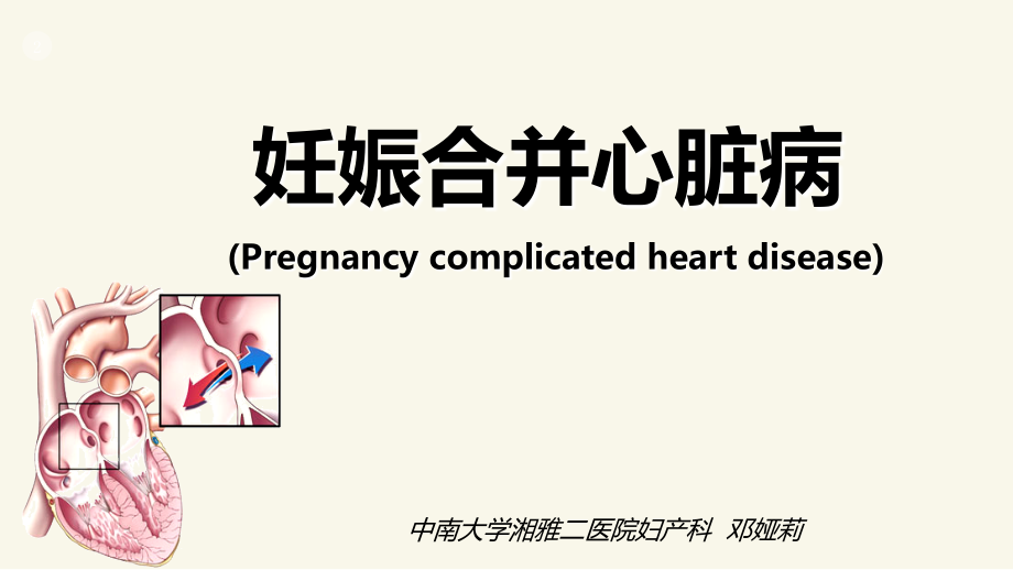 妊娠合并心脏病yld.ppt_第2页