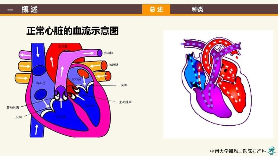 妊娠合并心脏病yld.ppt_第5页