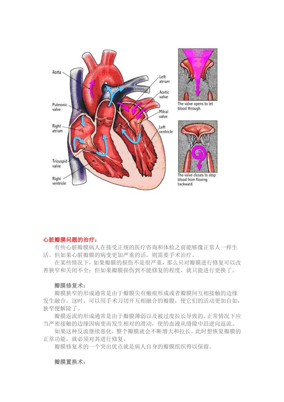 心脏瓣膜手术患者及家属必读_第2页