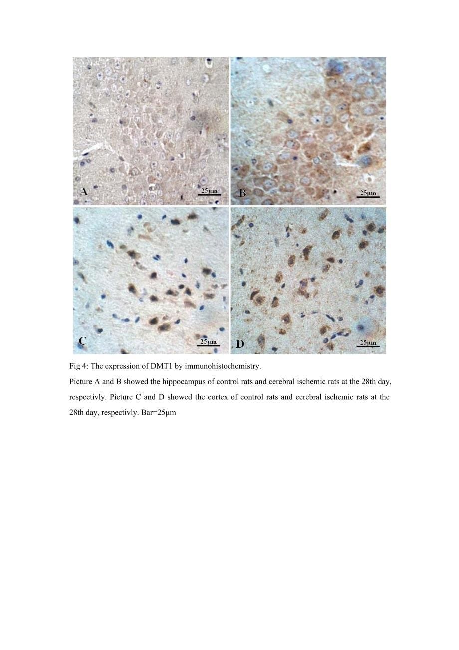 脑缺血诱导了大鼠皮层和海马二价金属离子转运体1表达增加 李艳伟[1_第5页