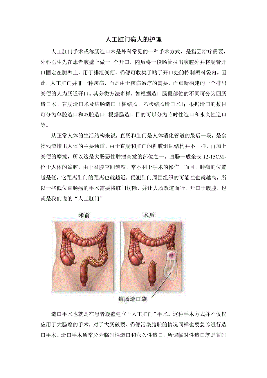 人工肛门病人的护理_第1页