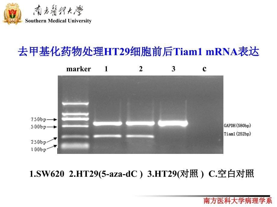 [医学保健]结直肠癌Tiam1高表达与其启动子低甲基化相关_第5页