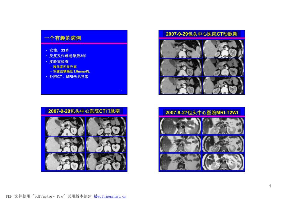 一个有趣的病例-肝胆胰脾MRI规范检查_第1页