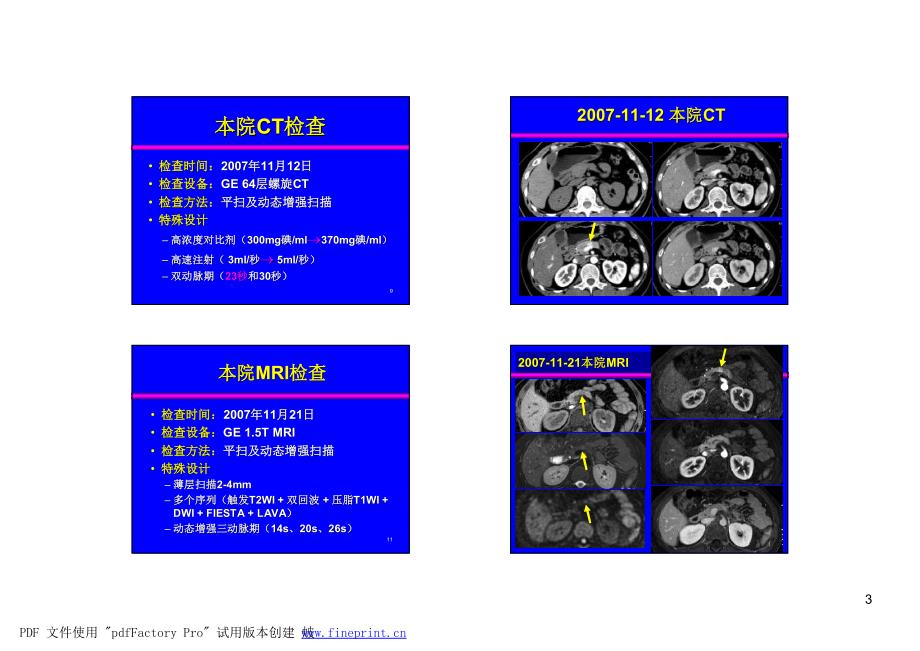 一个有趣的病例-肝胆胰脾MRI规范检查_第3页