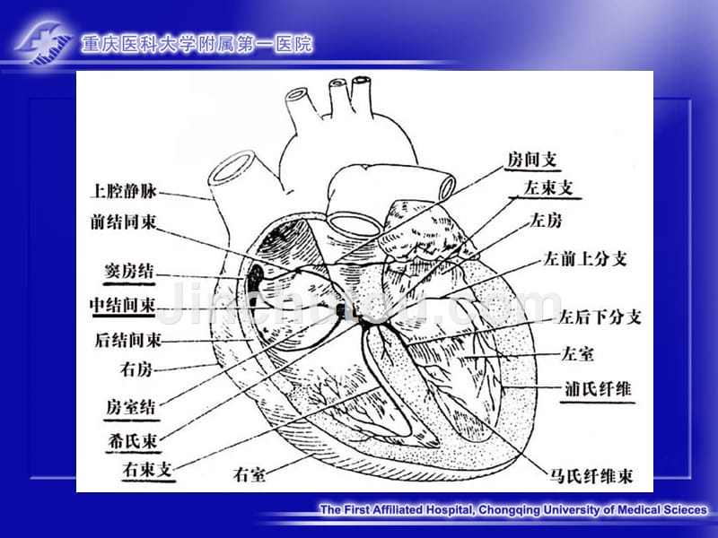 异常心电图pptPPT课件_第4页