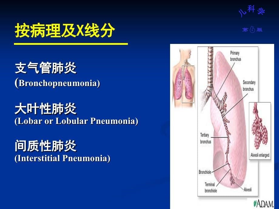 肺炎肺炎ppt-肺炎肺部疾病PPT课件_第5页