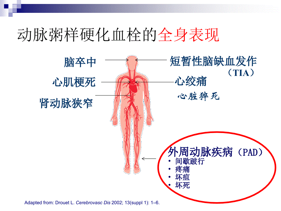 心脑血管疾病的预防-王海俊_第3页