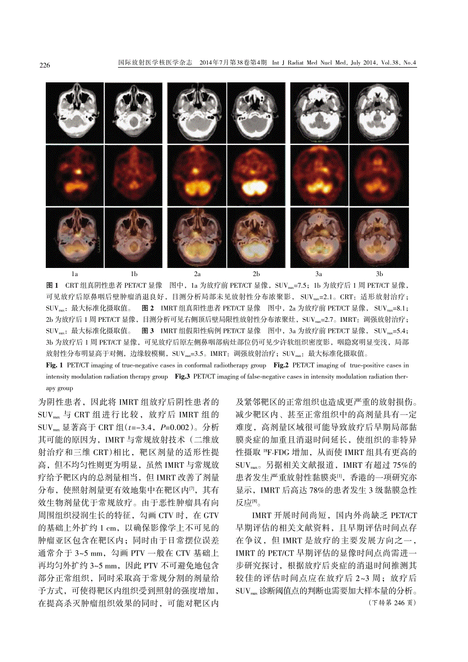 鼻咽癌不同模式放疗后的PETCT 早期评估价值的研究_第4页