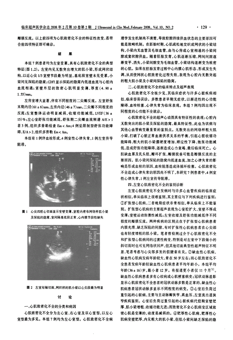 超声心动科诊断左室心肌致密化不全_第2页