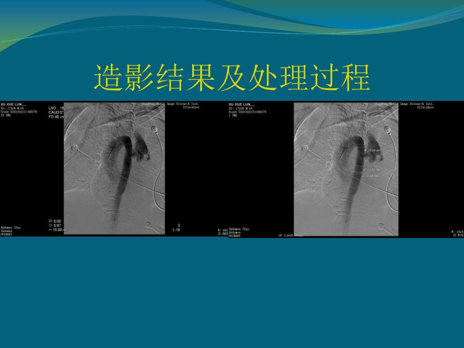 【PPT】-山东省立医院集团心血管中心国家心脏大血管临床重点科室_第3页