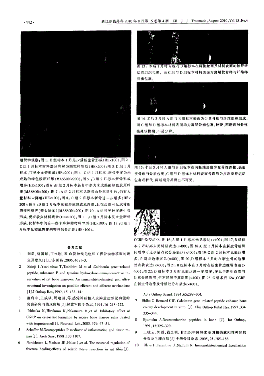 神经肽在神经化组织工程骨中表达的早期实验研究_第4页