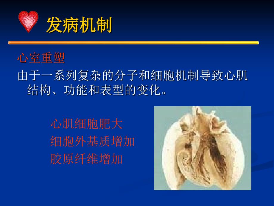 心力衰竭的抗炎性因子免疫调节治疗-课件，幻灯，ppt_第4页