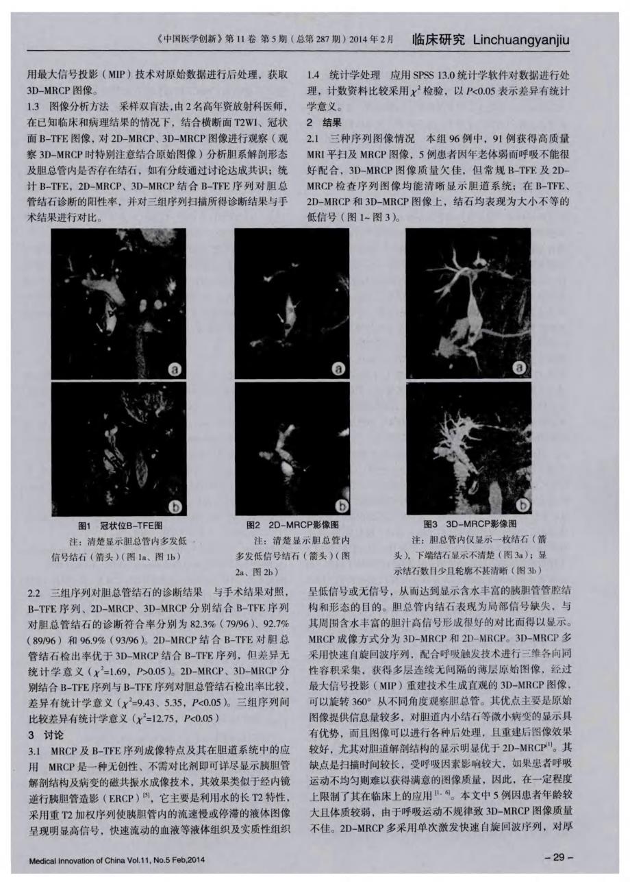 2D-MRCP、3D-MRCP结合冠状位B-TFE序列对胆总管结石诊断价值的比较_第2页