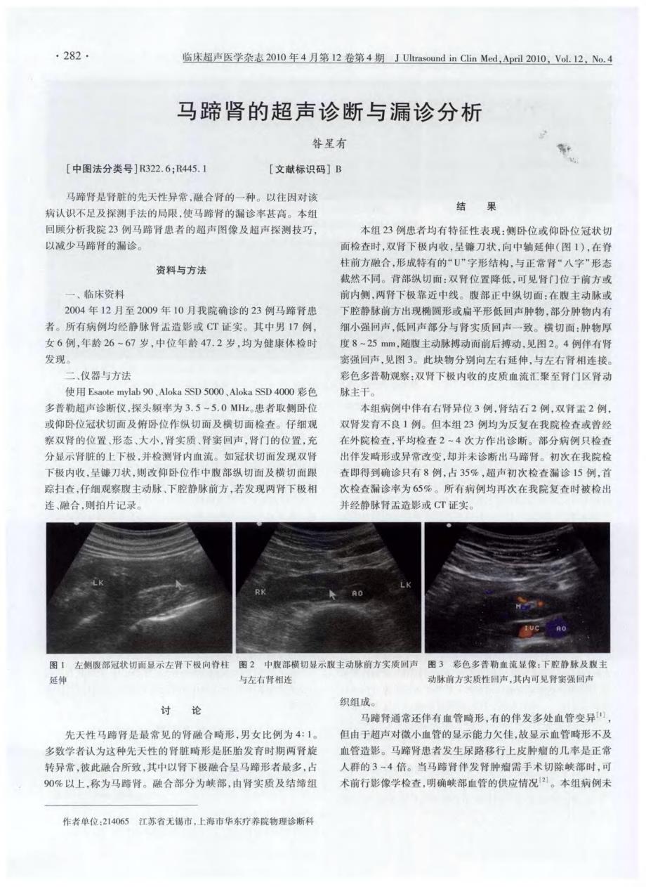 马蹄肾的超声诊断与漏诊分析_第1页