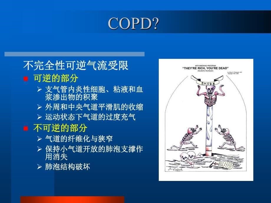 COPD病人围术期处理_第5页