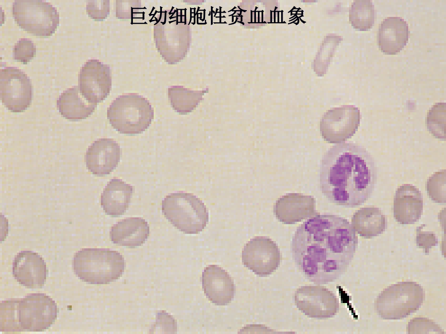 骨髓细胞形态学检查_第4页