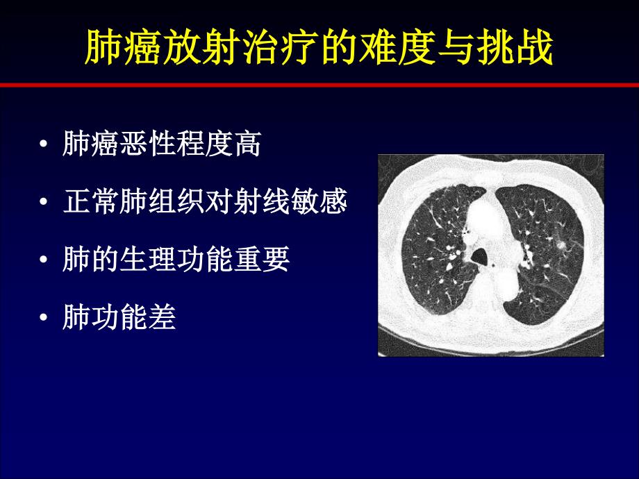早期非小细胞肺癌的放射治疗_第4页