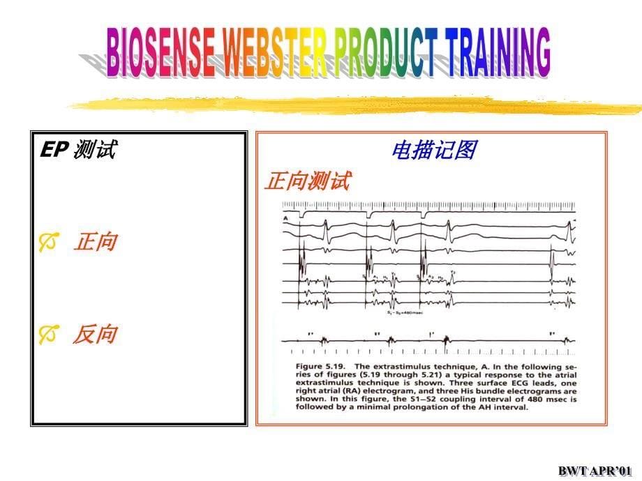 如何来获得心内心电图和几种主要病历实际的心电图_第5页