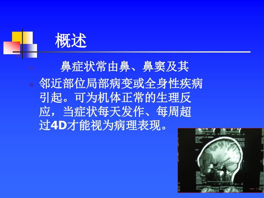 耳鼻咽喉头颈外科学——鼻科症状生理鼻部检查_第3页