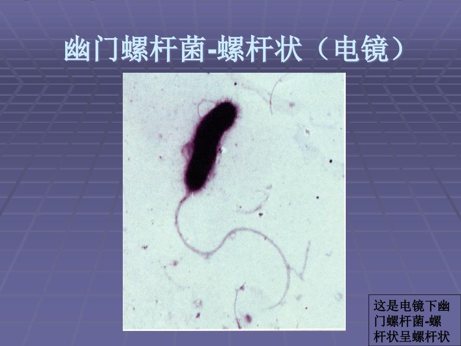 C13呼气试验_第4页