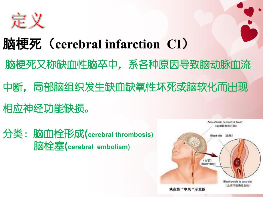 大面积脑梗死的护理 (新)_第4页