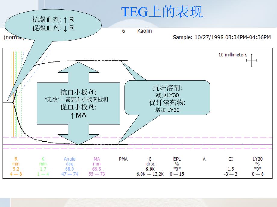 凝血药物知识_第3页