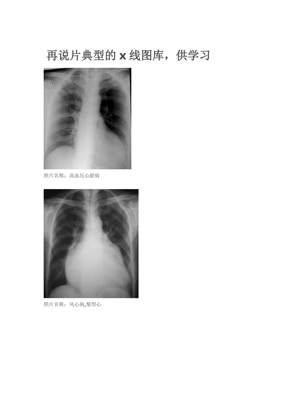 典型的x线图库_第1页