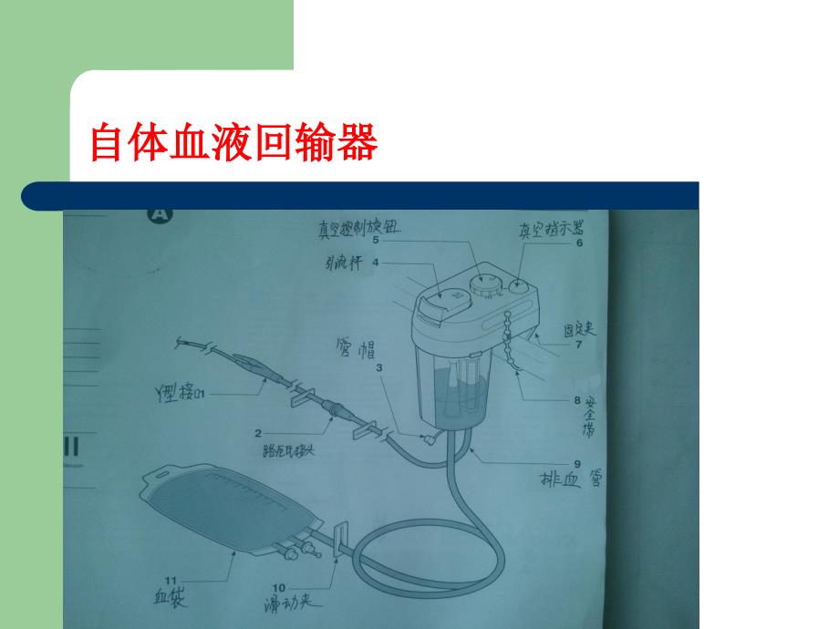 全膝关节置换的护理_第4页