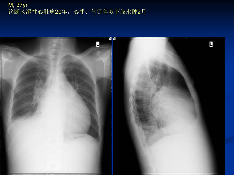 循环系统-实习课_第4页