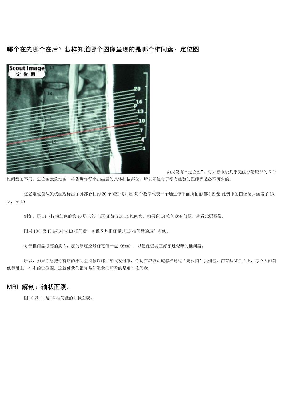 怎样看椎间盘CT_MRI_片_第2页