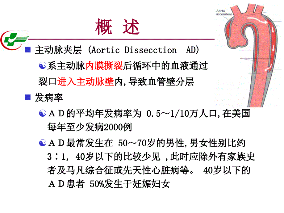 主动脉夹层课件_第2页