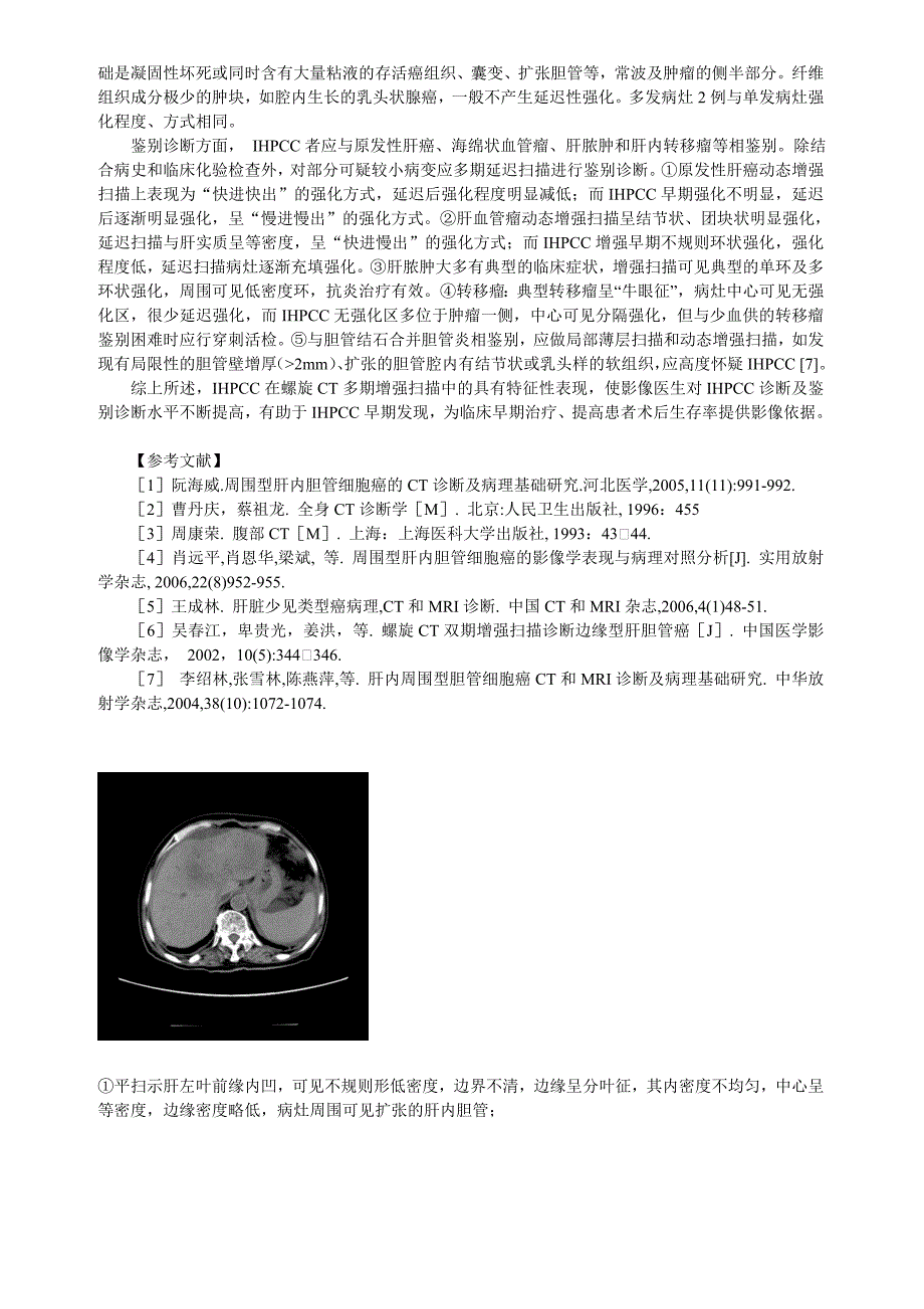 螺旋CT多期增强扫描在肝内周围型胆管细胞癌诊断中的应用价值_第3页