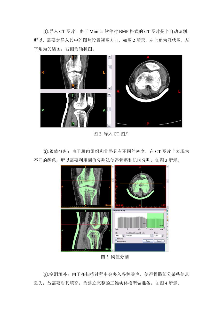 基于CT图像构建人体膝关节生物力学模型_第4页