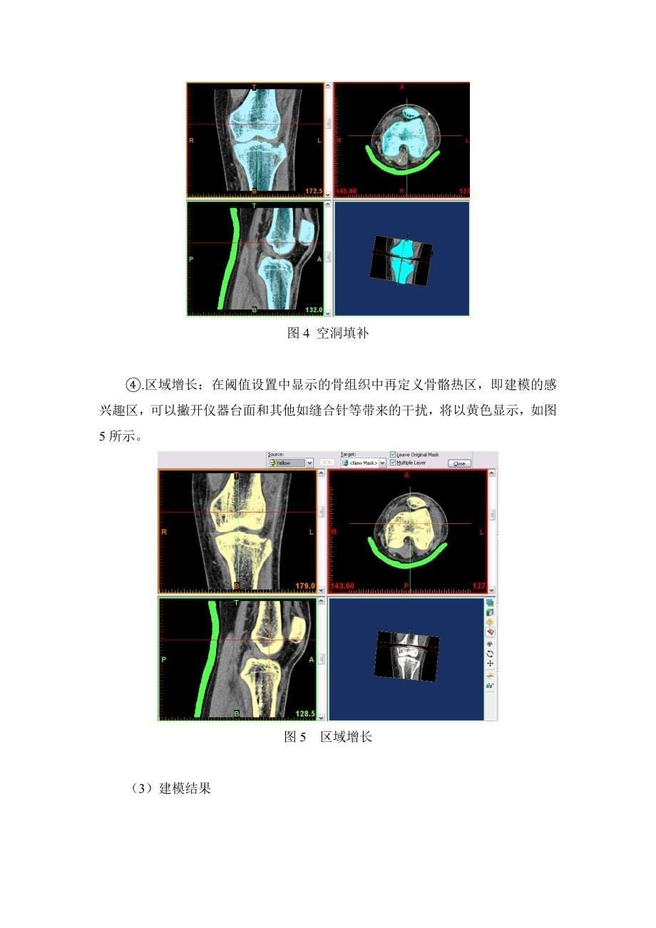 基于CT图像构建人体膝关节生物力学模型_第5页